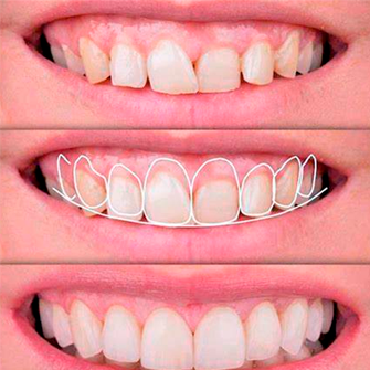 imagen sobre diseño.webp